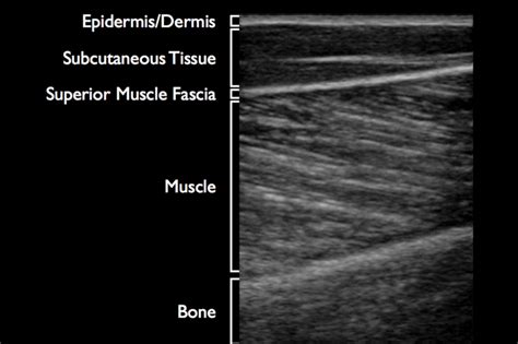 tests for soft tissue ligaments muscles|Ultrasound vs. MRI for Joint Issues .